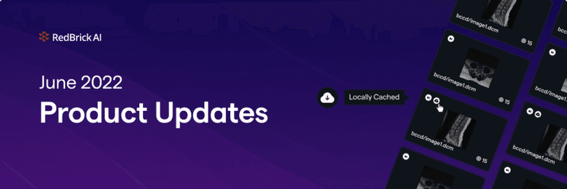 Fast Data Loading, Upgrades to 2D Annotation and More!