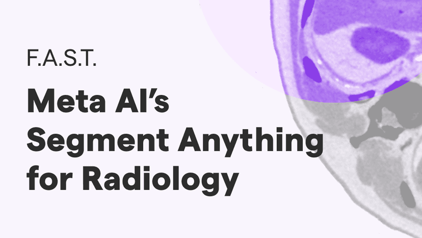 Introducing F.A.S.T: RedBrick AI's Fast Automated Segmentation Tool