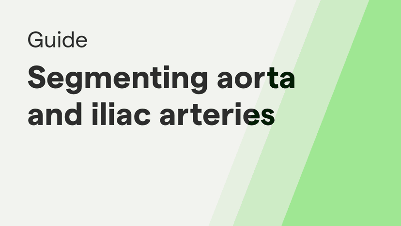 Guide: Segmenting the Aorta and Iliac Arteries in Abdominal CTA Scans