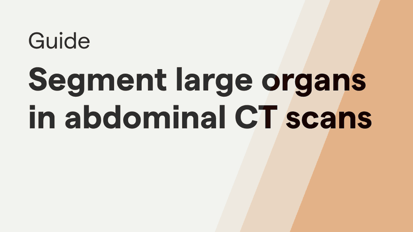 Guide: Segmentation of Large Organs in Abdominal CT Scans