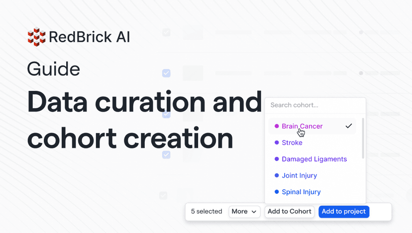 Data Curation and Cohort Creation on RedBrick AI