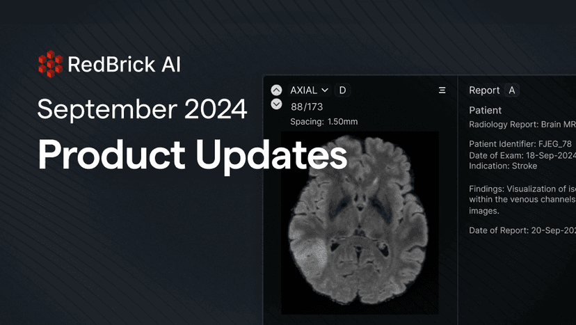 RedBrick AI September 2024 Product Updates