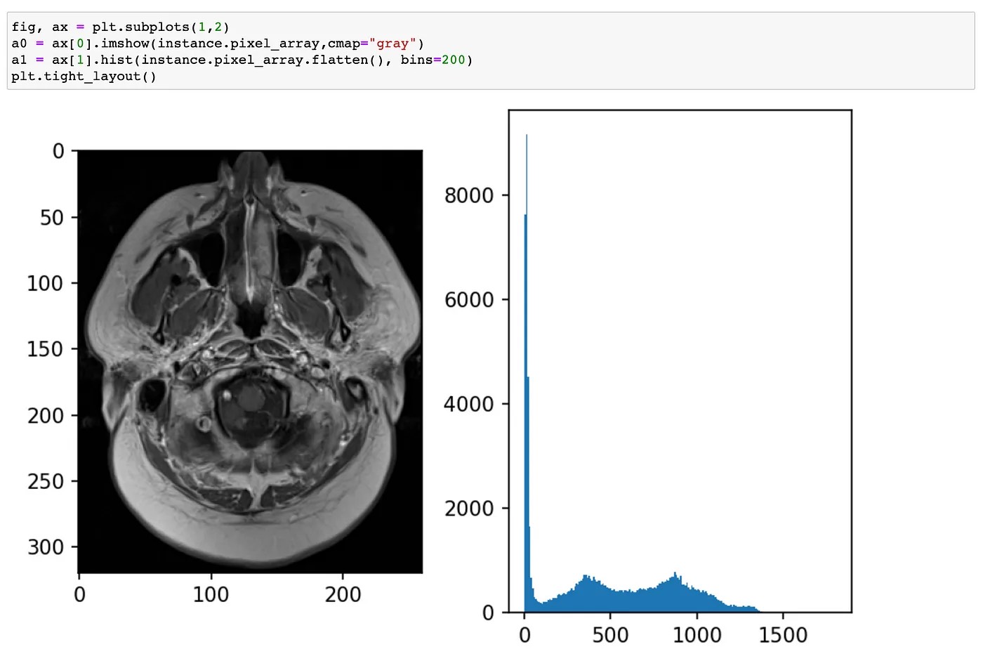 Pixel Value Distribution