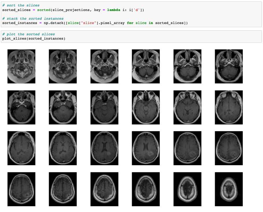 6432e0702bb6b407dca0a37e_1*PIdRyMnZ1Khv322ULBmw_Q.png
