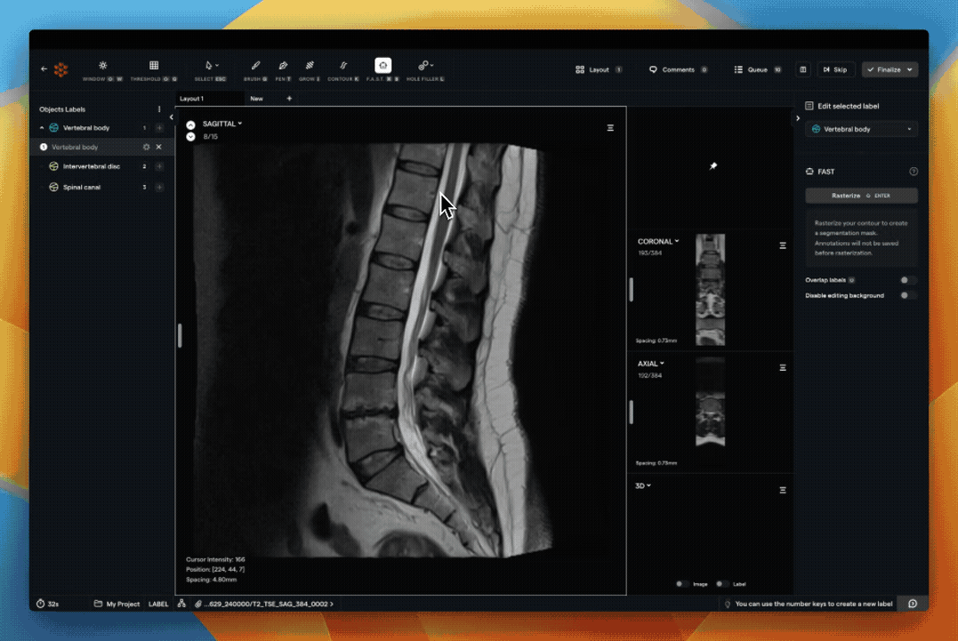 spine.gif