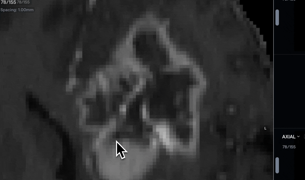 65af90e197bf1fa8617ac5c7_3-contour-types.gif