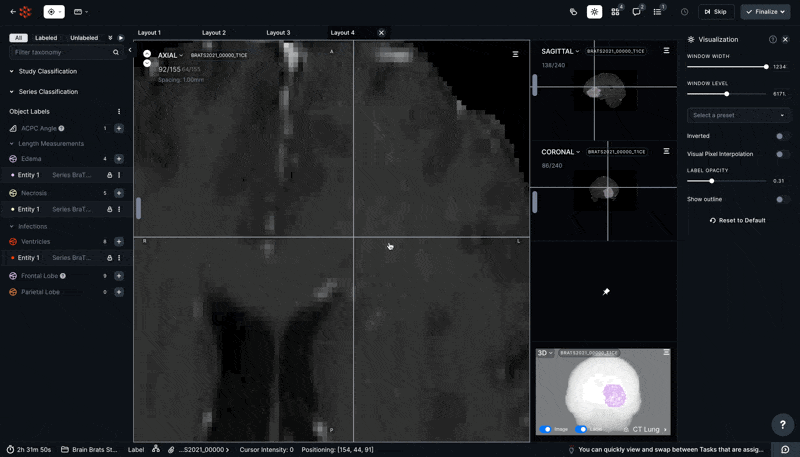 65af9422f12662528ce14356_Untitled.gif