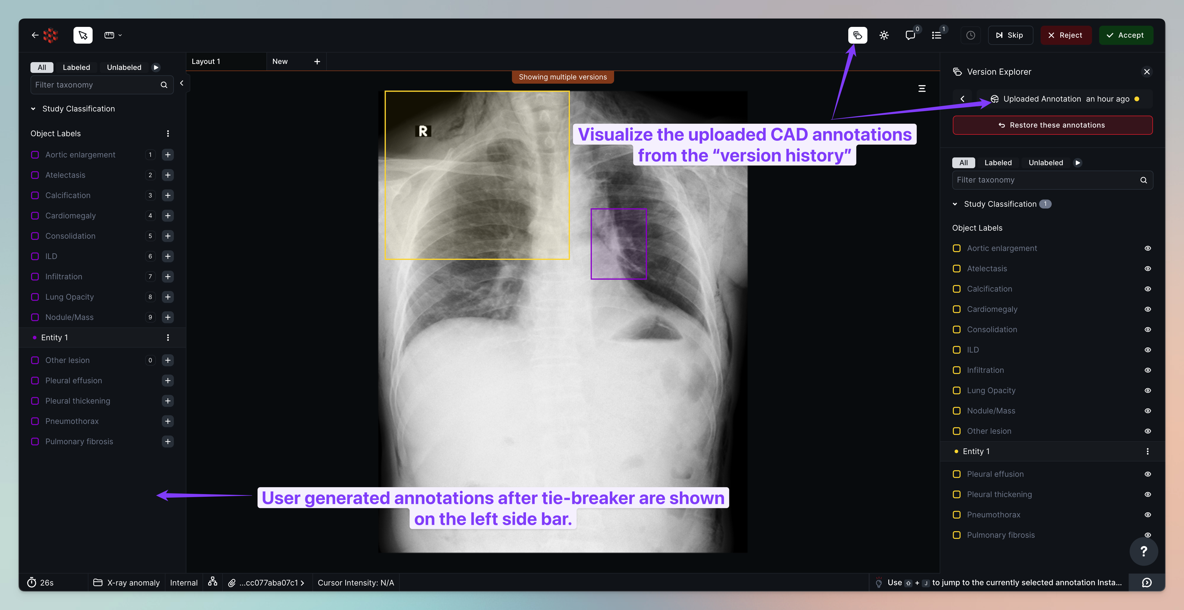 65c0955a5c3d7374ad5d961d_RedBrick AI 2024-02-05 at 12.09.49 2@2x.png
