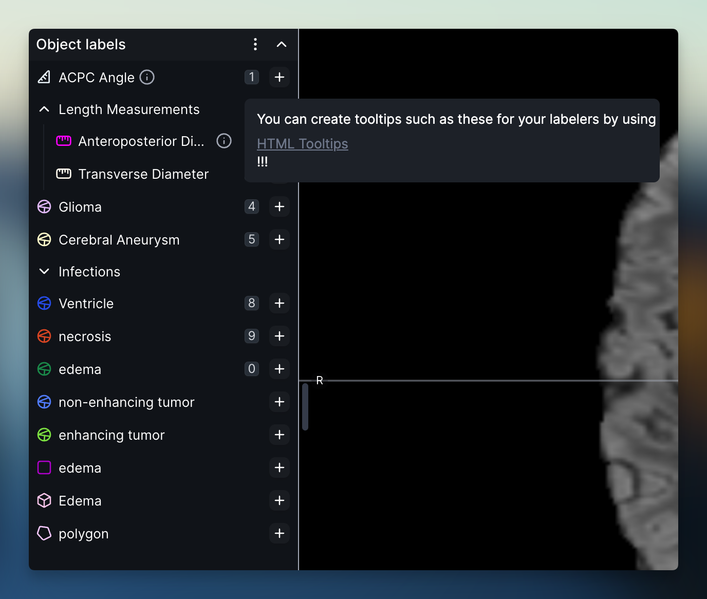 6629eb361e8805c27f40d559_RedBrick AI 2024-04-25 at 11.03.06@2x.png